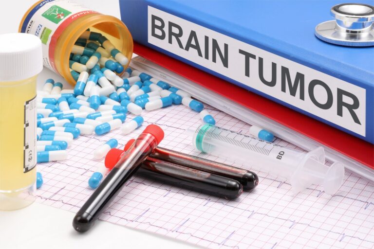 Unlocking the Secrets of Brain Tumor Management